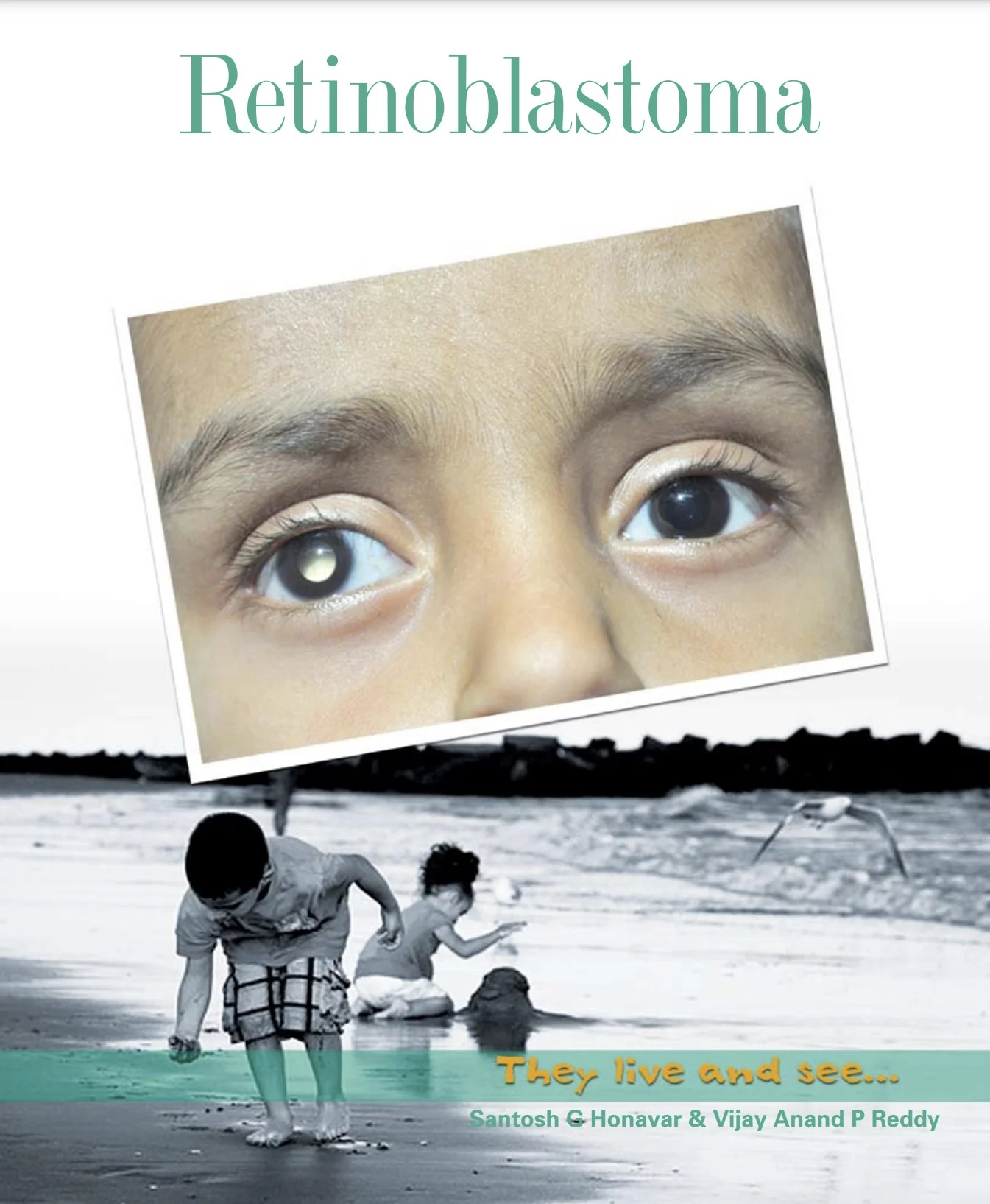 Retinoblastoma – They Live And See cover