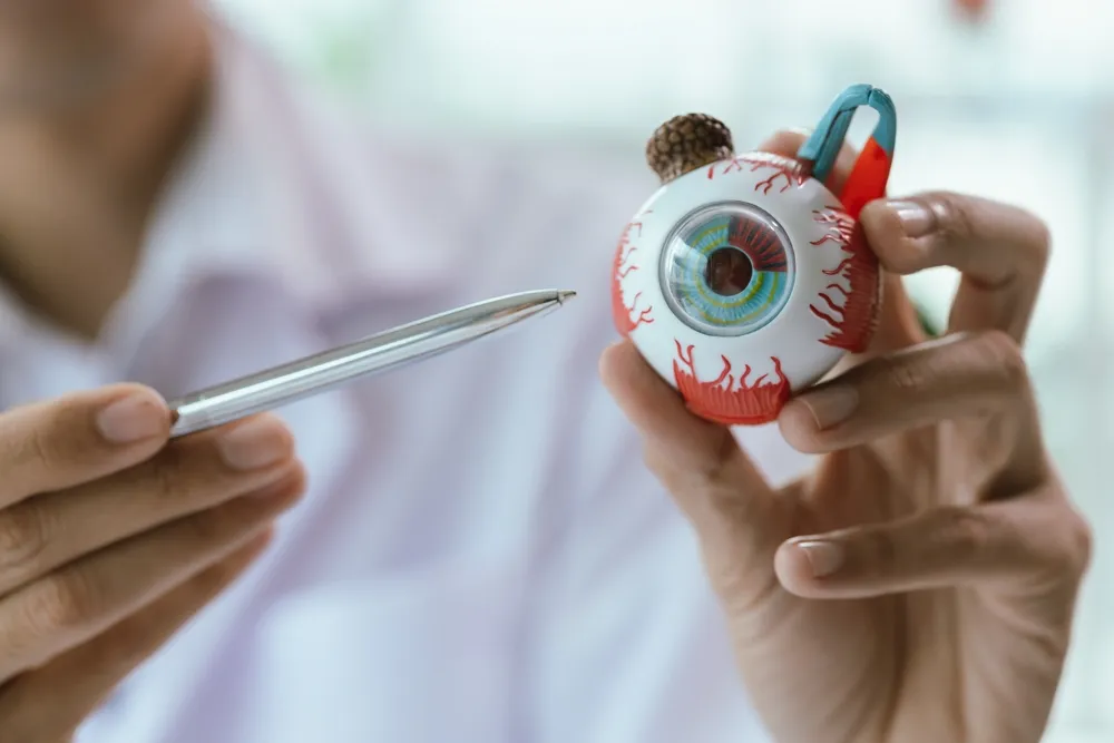 Eye Cancer Treatment in Hyderabad