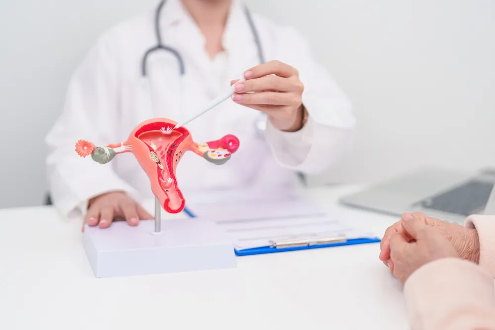Ovarian Cancer Treatment in Hyderabad